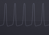 sub37_FDBK_as_osc.gif